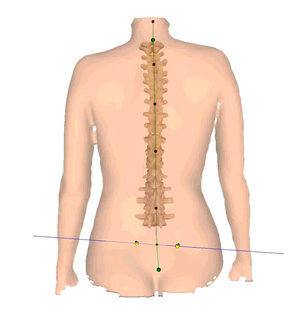 3D-spine-model_rotating